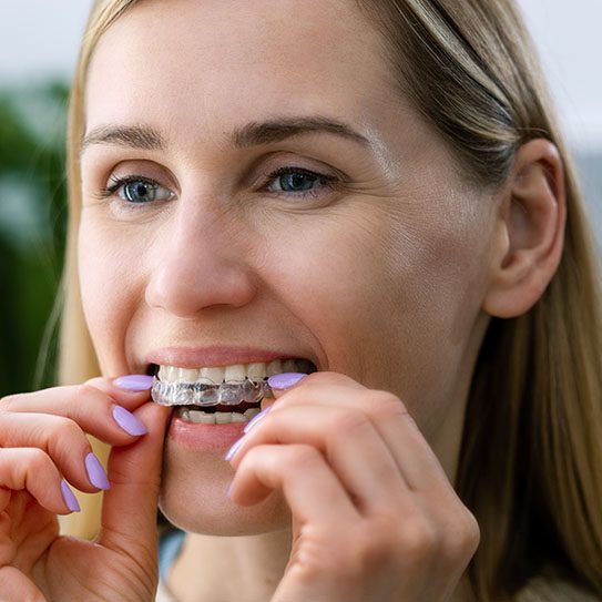 Invisalign dental office near me
