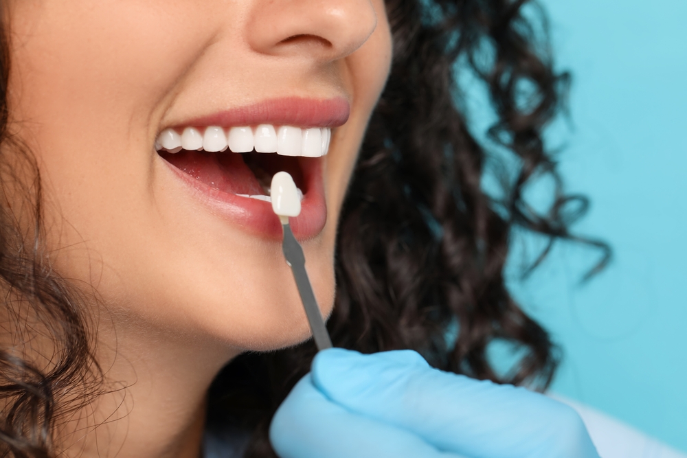 how porcelain crowns help restore your smile